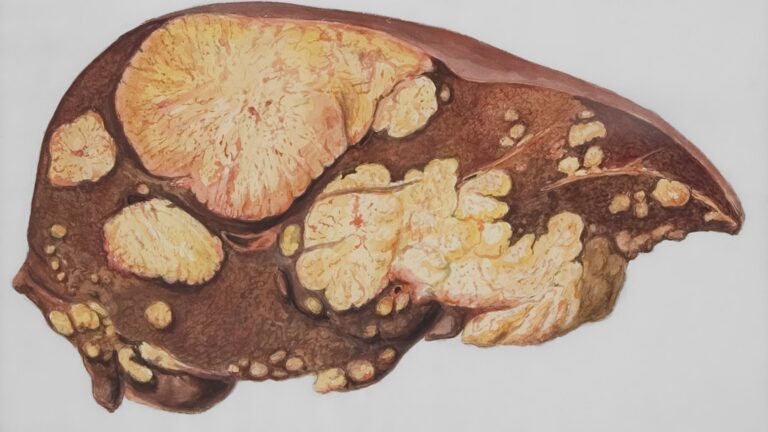 Sfaturi pentru sănătatea ficatului
